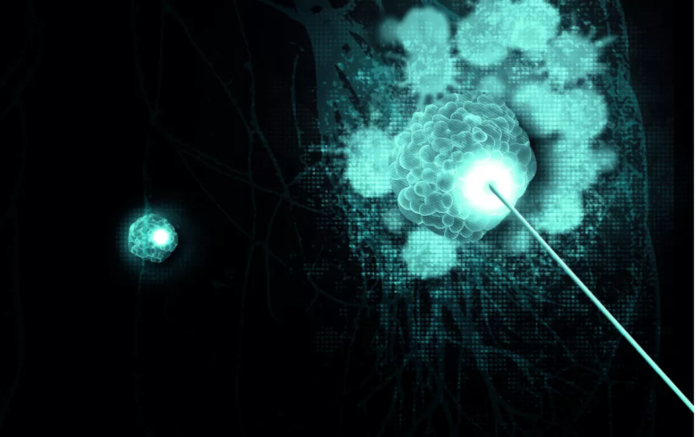 Immunotherapy treatments have revolutionized cancer management over the last decade. Th