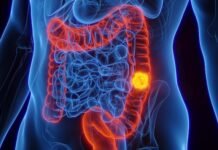 Pierre Fabre receives EC nod for colorectal cancer drug Pierre