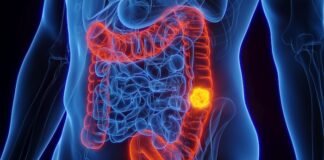 Pierre Fabre receives EC nod for colorectal cancer drug Pierre