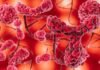 Why personalized care is reshaping the fight against blood cancer Cancer