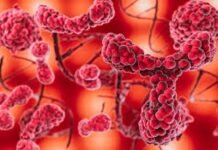 Why personalized care is reshaping the fight against blood cancer Cancer