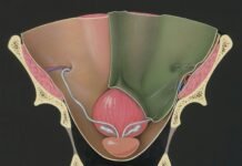 Cancer of the womb and early detection Cancer